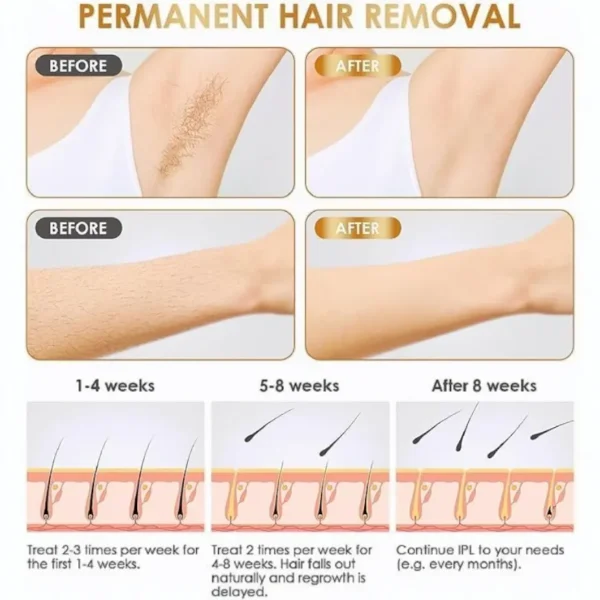 جهاز إزالة الشعر بالليزر المنزلي SE4 بدون ألم للاستخدام على الجسم كامل