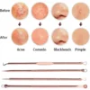 مجموعة ازالة الرؤوس السوداء 4 قطع ستانلس لتنظيف البشرة وازالة البثور وحب الشباب بسهولة